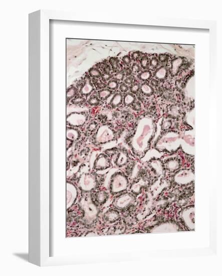 Lactating Breast Tissue, Light Micrograph-Steve Gschmeissner-Framed Photographic Print