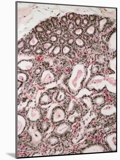 Lactating Breast Tissue, Light Micrograph-Steve Gschmeissner-Mounted Photographic Print