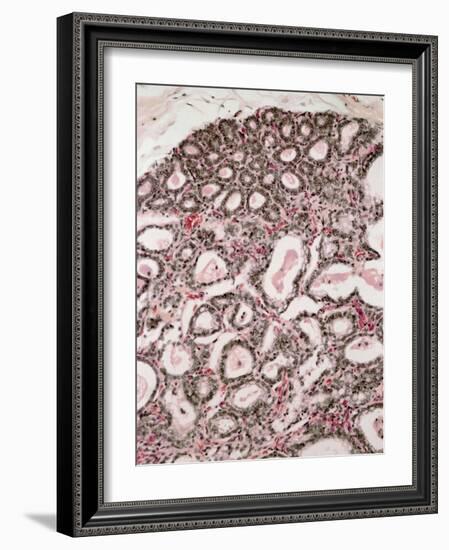 Lactating Breast Tissue, Light Micrograph-Steve Gschmeissner-Framed Photographic Print