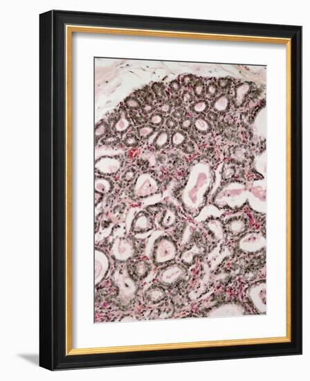 Lactating Breast Tissue, Light Micrograph-Steve Gschmeissner-Framed Photographic Print