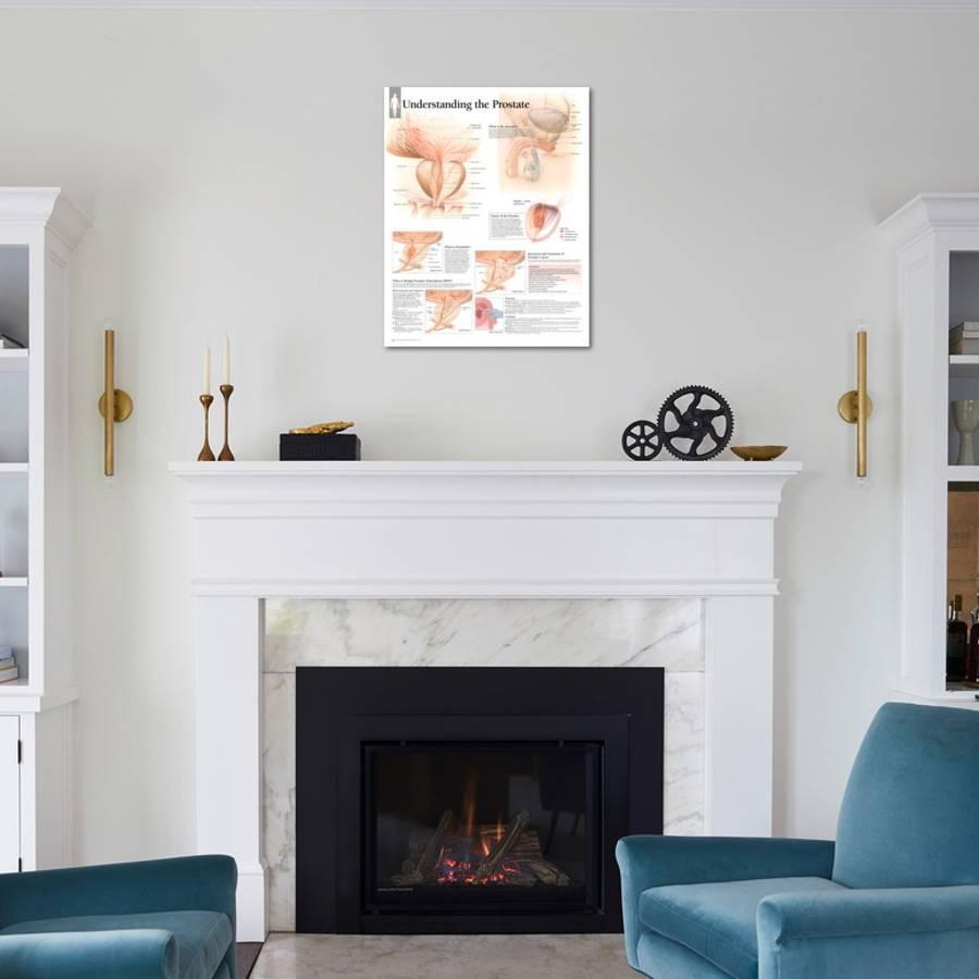 Laminated Understanding the Prostate Educational Chart Poster Laminated Poster by | Art.com