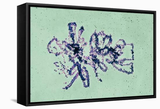 Lampbrush Chromosomes, TEM-Science Photo Library-Framed Premier Image Canvas