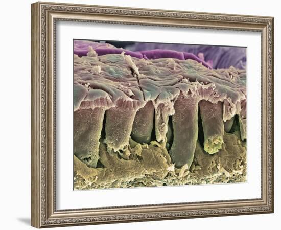 Large Intestine Lining, SEM-Steve Gschmeissner-Framed Photographic Print