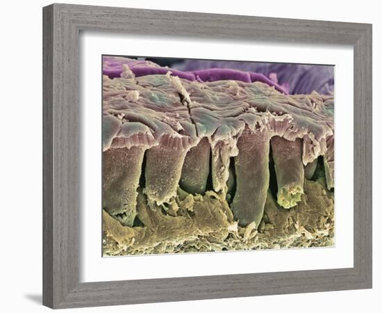 Large Intestine Lining, SEM-Steve Gschmeissner-Framed Photographic Print