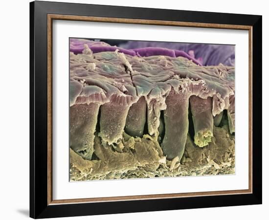 Large Intestine Lining, SEM-Steve Gschmeissner-Framed Photographic Print