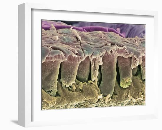 Large Intestine Lining, SEM-Steve Gschmeissner-Framed Photographic Print