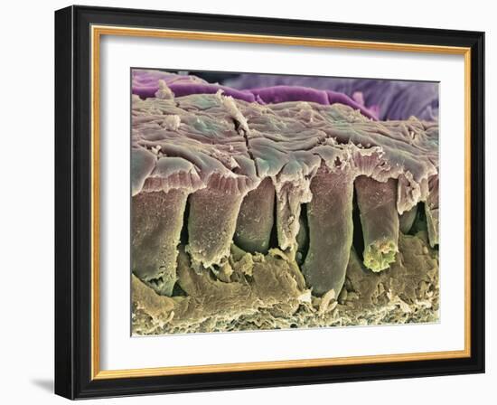 Large Intestine Lining, SEM-Steve Gschmeissner-Framed Photographic Print