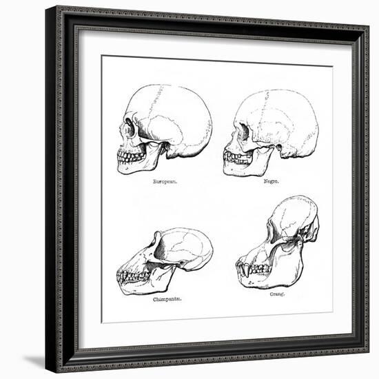 Lateral View of the Skull or Profile, 1848-null-Framed Giclee Print