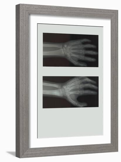 Left Hand-null-Framed Premium Giclee Print
