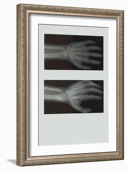 Left Hand-null-Framed Art Print