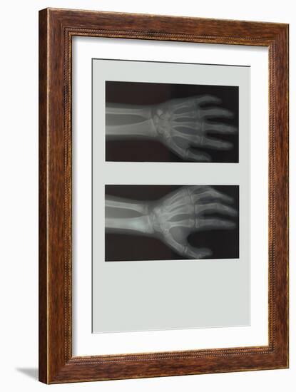 Left Hand-null-Framed Art Print