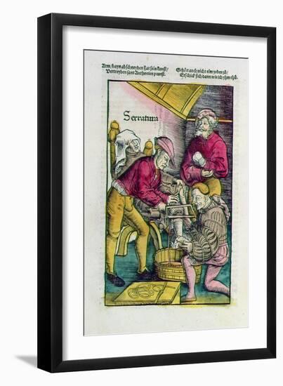 Leg Amputation, from the 'Field-Book of Wound Surgery', 1530-Hans von Gersdorff-Framed Giclee Print