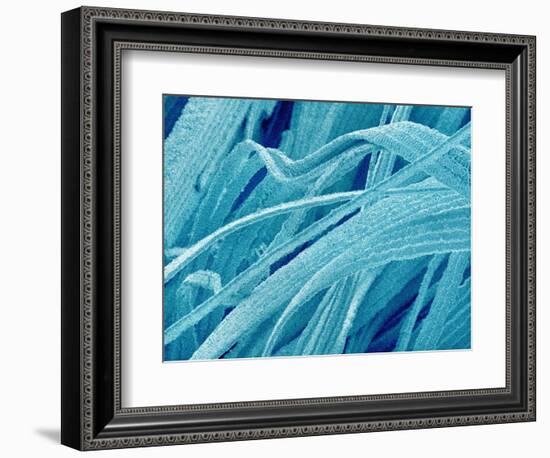 Lens fiber of a rabbit eye-Micro Discovery-Framed Photographic Print