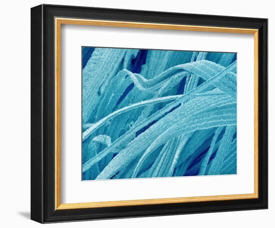 Lens fiber of a rabbit eye-Micro Discovery-Framed Photographic Print