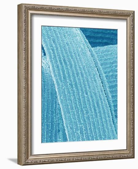 Lens fiber of eye (rabbit)-Micro Discovery-Framed Photographic Print