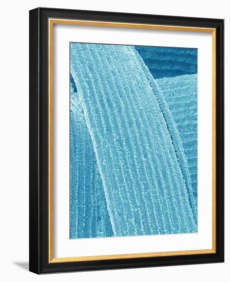 Lens fiber of eye (rabbit)-Micro Discovery-Framed Photographic Print