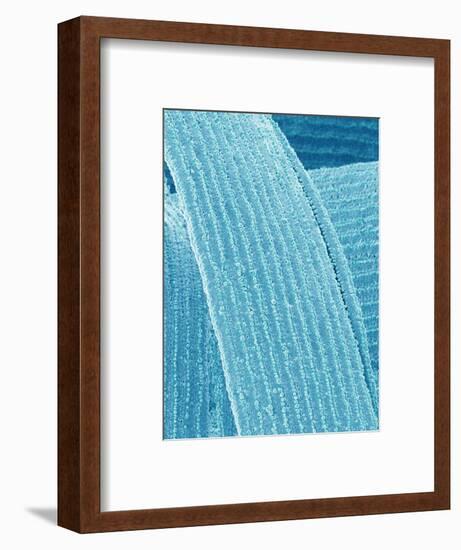 Lens fiber of eye (rabbit)-Micro Discovery-Framed Photographic Print