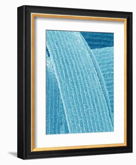 Lens fiber of eye (rabbit)-Micro Discovery-Framed Photographic Print