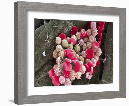 Leukaemia Blood Cells, SEM-Steve Gschmeissner-Framed Photographic Print