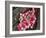 Leukaemia Blood Cells, SEM-Steve Gschmeissner-Framed Photographic Print