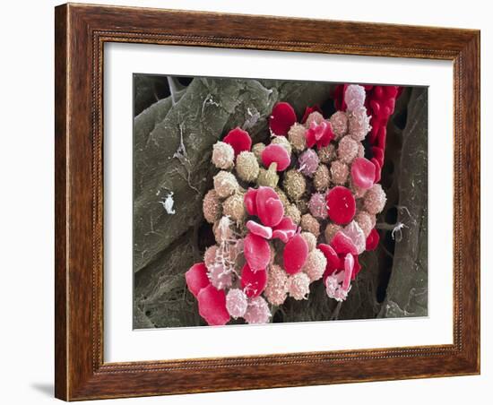 Leukaemia Blood Cells, SEM-Steve Gschmeissner-Framed Photographic Print