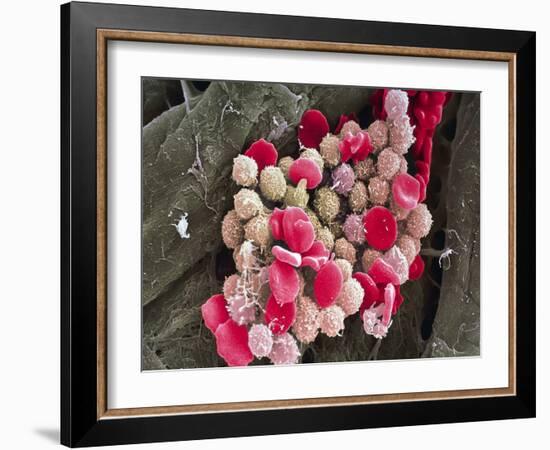 Leukaemia Blood Cells, SEM-Steve Gschmeissner-Framed Photographic Print