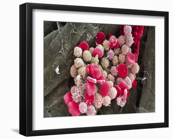 Leukaemia Blood Cells, SEM-Steve Gschmeissner-Framed Photographic Print