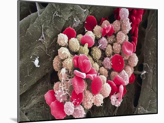 Leukaemia Blood Cells, SEM-Steve Gschmeissner-Mounted Photographic Print