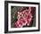 Leukaemia Blood Cells, SEM-Steve Gschmeissner-Framed Photographic Print