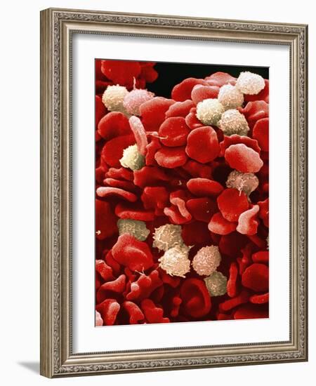 Leukaemia Blood Cells, SEM-Steve Gschmeissner-Framed Photographic Print