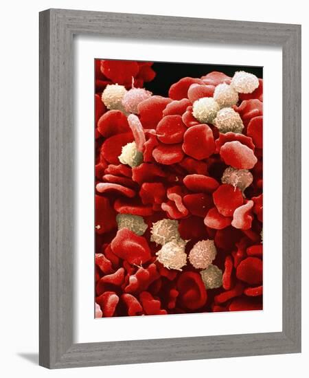 Leukaemia Blood Cells, SEM-Steve Gschmeissner-Framed Photographic Print