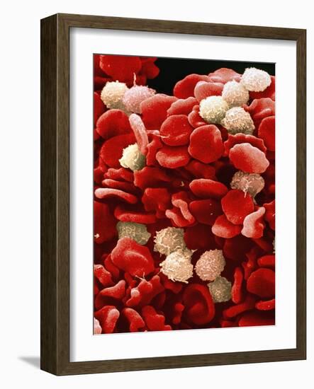 Leukaemia Blood Cells, SEM-Steve Gschmeissner-Framed Photographic Print