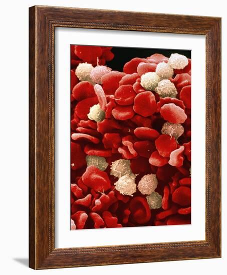 Leukaemia Blood Cells, SEM-Steve Gschmeissner-Framed Photographic Print