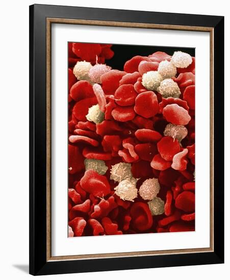 Leukaemia Blood Cells, SEM-Steve Gschmeissner-Framed Photographic Print