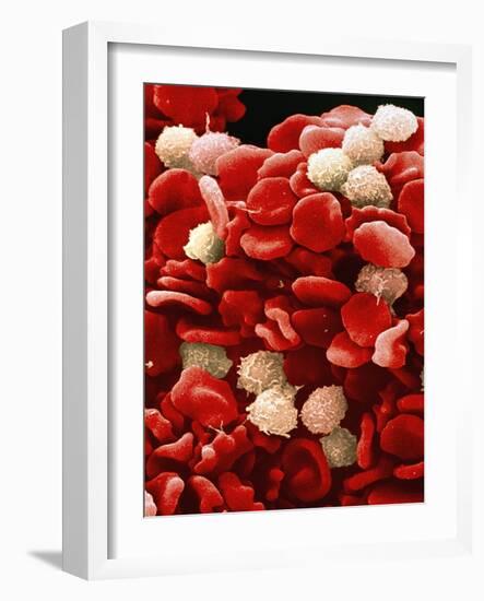 Leukaemia Blood Cells, SEM-Steve Gschmeissner-Framed Photographic Print