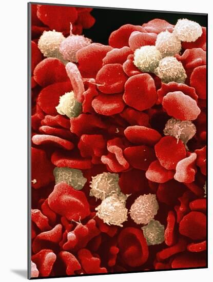 Leukaemia Blood Cells, SEM-Steve Gschmeissner-Mounted Photographic Print