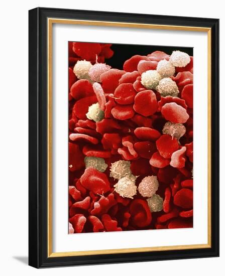 Leukaemia Blood Cells, SEM-Steve Gschmeissner-Framed Photographic Print