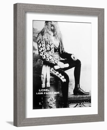 Lion-Faced Man, 1907-null-Framed Photographic Print