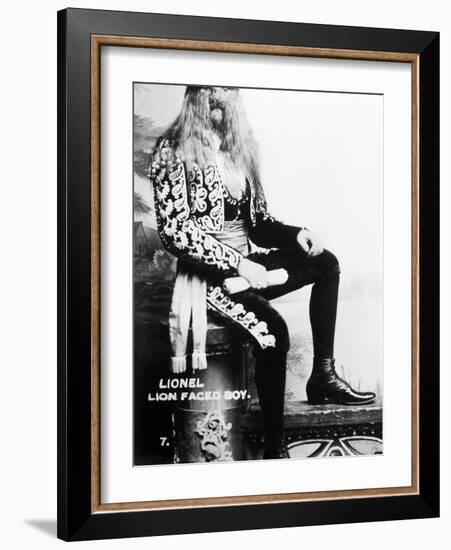 Lion-Faced Man, 1907-null-Framed Photographic Print