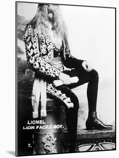 Lion-Faced Man, 1907-null-Mounted Photographic Print