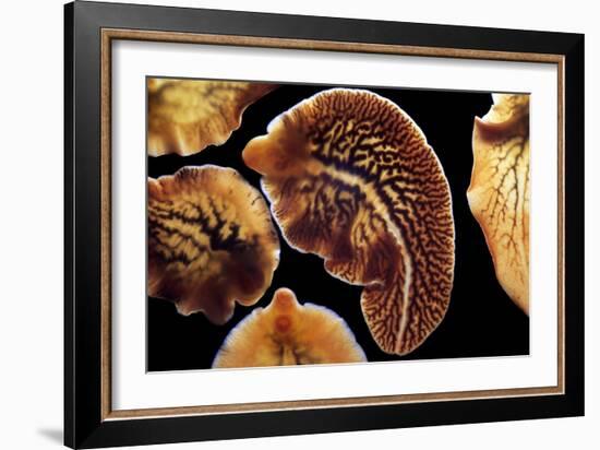 Liver Flukes, Macro Photograph-Sinclair Stammers-Framed Photographic Print