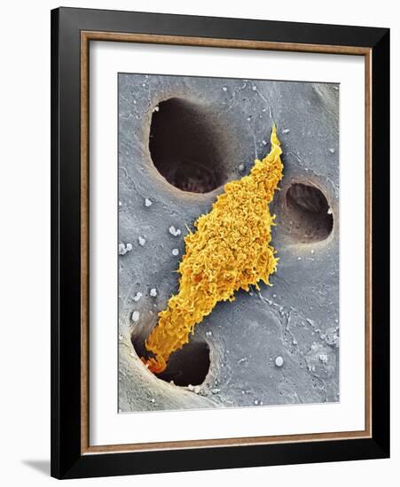 Liver Macrophage Cell, SEM-Thomas Deerinck-Framed Photographic Print