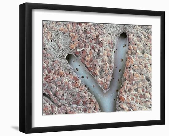 Liver Vein, SEM-Thomas Deerinck-Framed Photographic Print