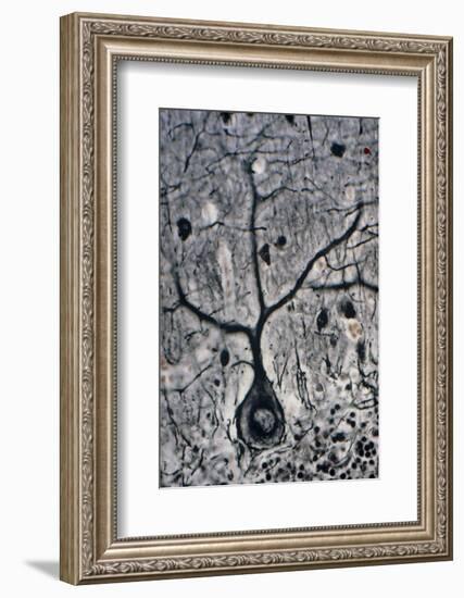 LM of a Purkinje Cell In the Cerebellum-Volker Steger-Framed Photographic Print