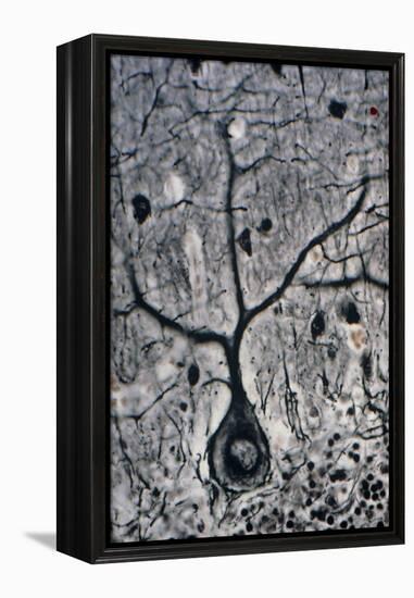 LM of a Purkinje Cell In the Cerebellum-Volker Steger-Framed Premier Image Canvas