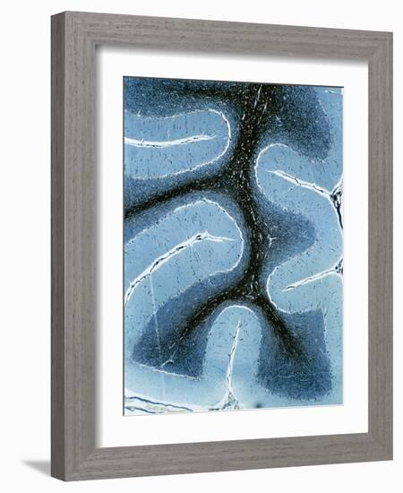 LM of Cortex And Medulla of the Cerebellum-Volker Steger-Framed Photographic Print