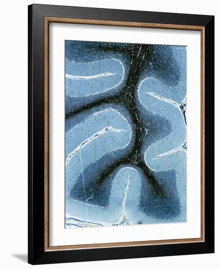 LM of Cortex And Medulla of the Cerebellum-Volker Steger-Framed Photographic Print