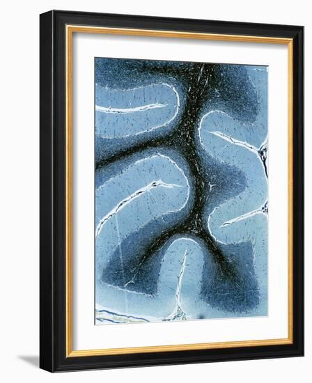 LM of Cortex And Medulla of the Cerebellum-Volker Steger-Framed Photographic Print