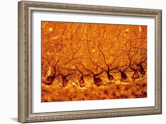 LM of Purkinje Nerves Cells In the Cerebe-Volker Steger-Framed Photographic Print