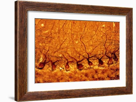 LM of Purkinje Nerves Cells In the Cerebe-Volker Steger-Framed Photographic Print